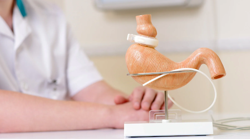 Adjustment Procedures in Lap