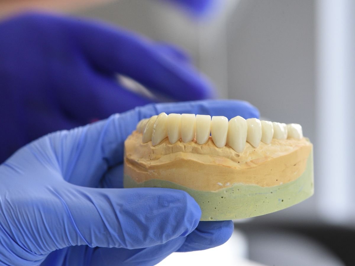 The Evolution Of Implant Dentistry